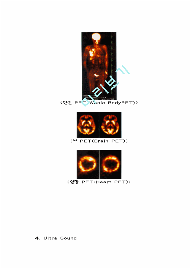 MRI(Magnetic Resonace Image)   (8 )